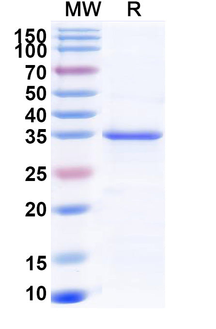 Recombinant Monkeypox virus/MPXV A27L Protein, N-His