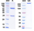 SDS-PAGE for Anti-Vaccinia virus(VACV) D8L Antibody (LA5).