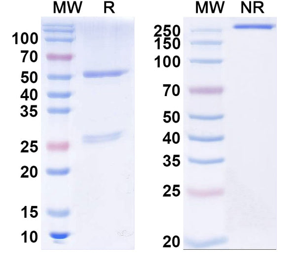 SDS-PAGE for Anti-CSFV Viroporin p7 Antibody (1A036)
