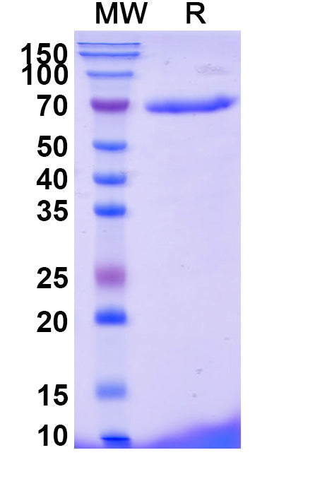 Recombinant Monkeypox virus/MPXV C18L Protein, N-His