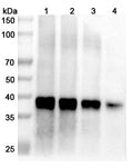 Western blot analysis was performed using anti-Langya virus Matrix protein polyclonal antibody at 1μg/ml on various samples.
Lane 1: recombinant Langya virus/LayV M/Matrix (Catalog No: VK718012), 70 ug
Lane 2: recombinant Langya virus/LayV M/Matrix (Catalog No: VK718012), 50 ug
Lane 3: recombinant Langya virus/LayV M/Matrix (Catalog No: VK718012), 30 ug
Lane 4: recombinant Langya virus/LayV M/Matrix (Catalog No: VK718012), 10 ug