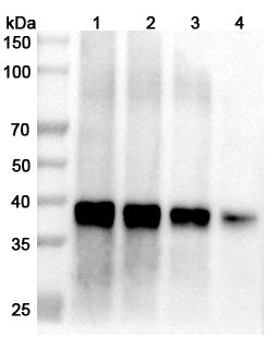 Western blot analysis was performed using anti-Langya virus Matrix protein polyclonal antibody at 1μg/ml on various samples.
Lane 1: recombinant Langya virus/LayV M/Matrix (Catalog No: VK718012), 70 ug
Lane 2: recombinant Langya virus/LayV M/Matrix (Catalog No: VK718012), 50 ug
Lane 3: recombinant Langya virus/LayV M/Matrix (Catalog No: VK718012), 30 ug
Lane 4: recombinant Langya virus/LayV M/Matrix (Catalog No: VK718012), 10 ug