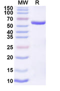 Recombinant JUNV Nucleoprotein, N-His