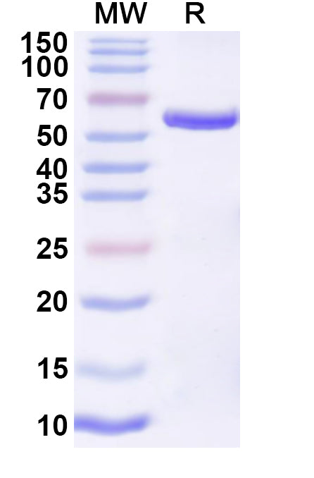 Recombinant JUNV Nucleoprotein, N-His