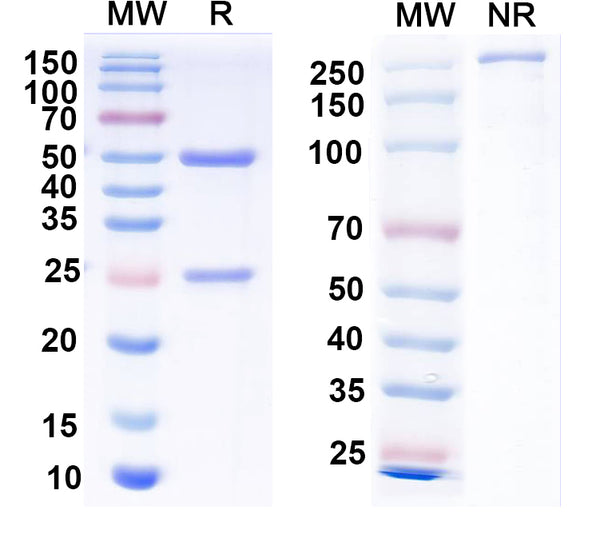 SDS-PAGE for Anti-EBV/HHV-4 gH & gL Complex Antibody (E1D1).