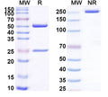 SDS-PAGE for Anti-HHV2/HSV2 gD/US6 Antibody (1A001)