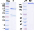 SDS-PAGE for Anti-HSV2/HHV-2 gD/US6 Monoclonal Antibody (1A150)