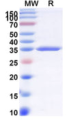 Recombinant Monkeypox virus/MPXV D13L Protein, N-His
