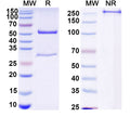 SDS-PAGE for Anti-HCV ssRNA & Genome polyprotein Antibody (Fab HCV3)