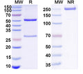 SDS-PAGE for Anti-HCV ssRNA & Genome polyprotein Antibody (Fab HCV2)