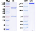 SDS-PAGE for Anti-SARS-CoV-2 S2 Protein antibody (2G5).