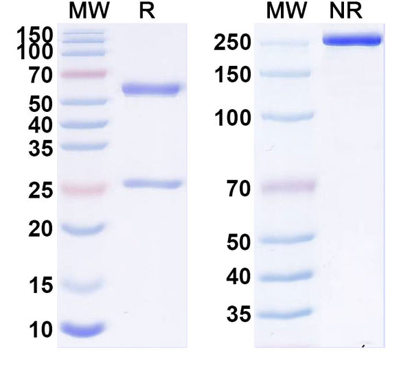 SDS-PAGE for Anti-SARS-CoV-2 S2 Protein antibody (2G5).