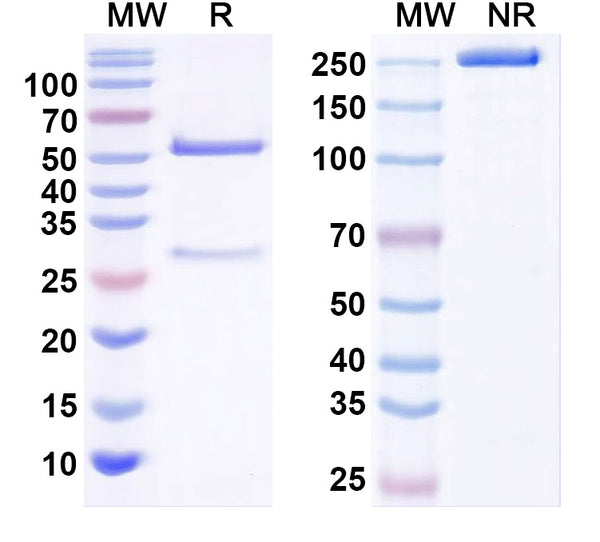 SDS-PAGE for Anti-SARS-CoV-2 S2 Protein Monoclonal Antibody (1A160)