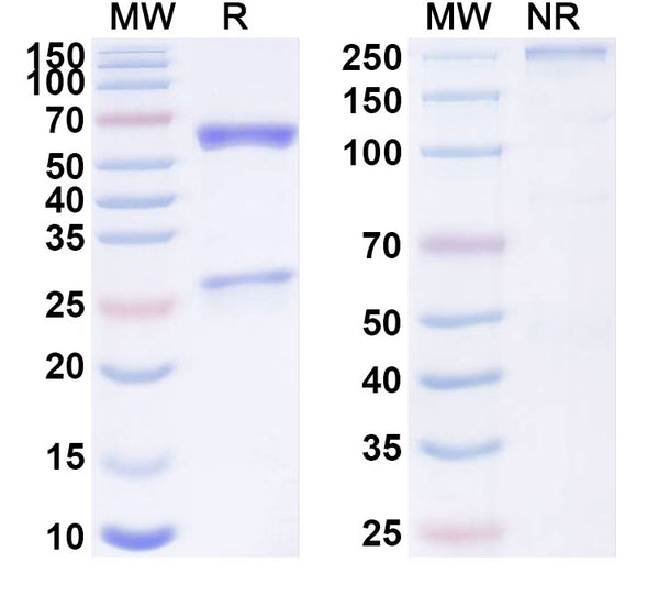 SDS-PAGE for Anti-SARS-CoV-2 S2 Protein antibody (2F8).