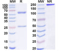 SDS-PAGE for Anti-SARS-CoV-2 S2 Protein antibody (1D10).