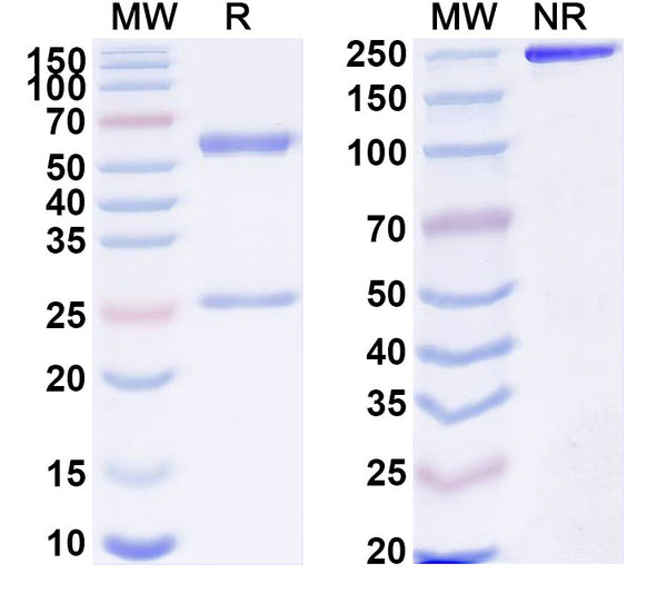 SDS-PAGE for Anti-SARS-CoV-2 S2 Protein antibody (1D10).