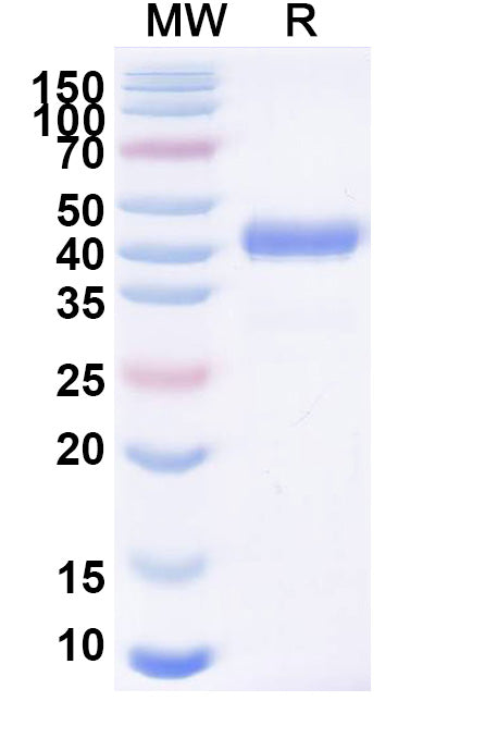 SDS-PAGE for Anti-CSFV Glycoprotein E2 Antibody (SAA2221).