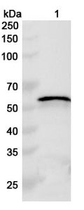 Western blot analysis was performed using anti-TRX1 polyclonal antibody at 1ug/mL on various samples.
Lane 1: recombinant HSV-1/HHV-1 TRX1/UL38 (Catalog No: VK751012)