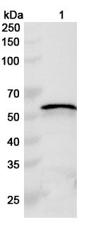 Western blot analysis was performed using anti-TRX1 polyclonal antibody at 1ug/mL on various samples.
Lane 1: recombinant HSV-1/HHV-1 TRX1/UL38 (Catalog No: VK751012)