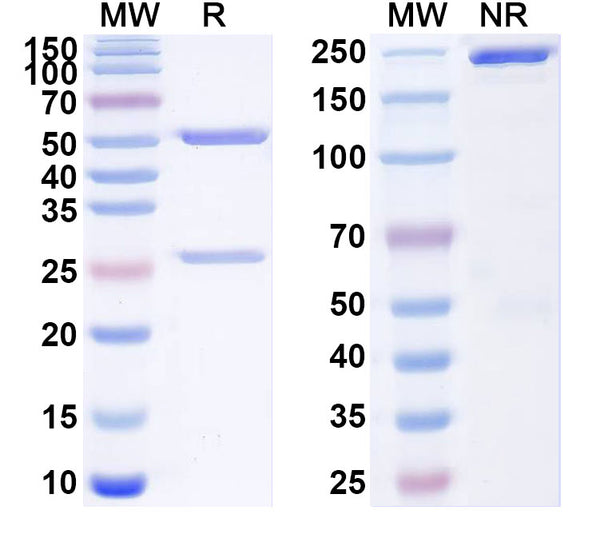 SDS-PAGE for Anti-SARS-CoV-2 NTD antibody (1B2).