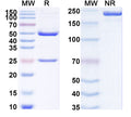 SDS-PAGE for Anti-SARS-CoV-2 NTD antibody (1B6).