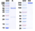 SDS-PAGE for Anti-SARS-CoV-2 NTD antibody (1C4).