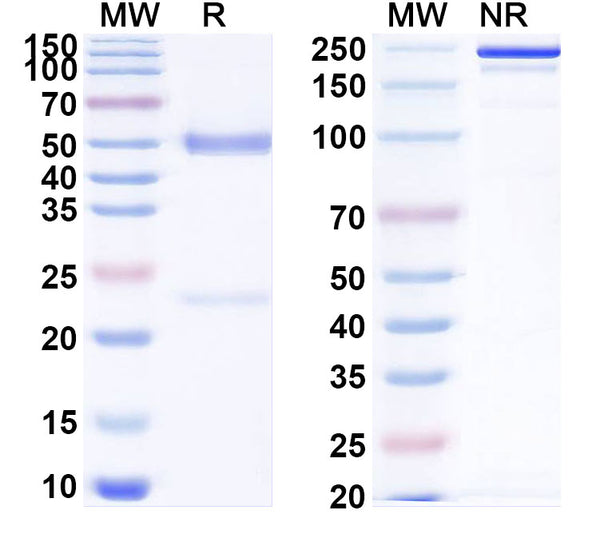 SDS-PAGE for Anti-SARS-CoV-2 NTD antibody (1C4).