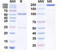SDS-PAGE for Anti-SARS-CoV-2 NTD antibody (1E1#).