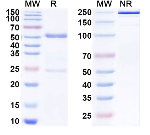 SDS-PAGE for Anti-SARS-CoV-2 NTD antibody (1E1#).