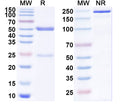 SDS-PAGE for Anti-SARS-CoV-2 NTD antibody (1G3).