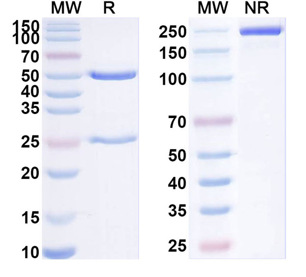 SDS-PAGE for Anti-SARS-CoV-2 NTD antibody (1H12).