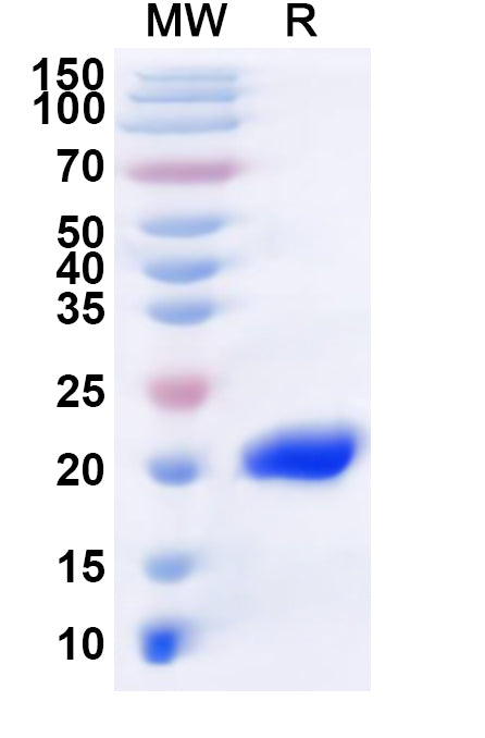 Recombinant LSDV IMV envelope protein/LSDV060 Protein, N-His