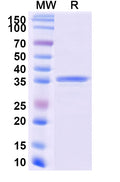 Recombinant Monkeypox virus/MPXV A26L Protein, N-GST & C-His