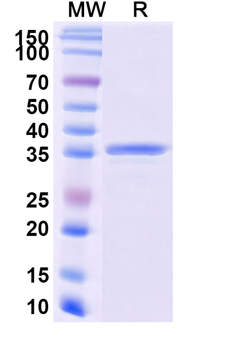 Recombinant Monkeypox virus/MPXV A26L Protein, N-GST & C-His