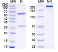 SDS-PAGE for Anti-CPV2/FPV Capsid protein VP1 Antibody (SAA0843)