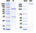 SEC-HPLC detection for Anti-HBV-D HBcAg/HBeAg Antibody (E13#).
