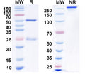 SDS-PAGE for Anti-HBV HBcAg Monoclonal Antibody (1A243)