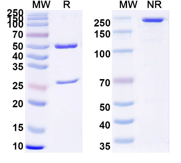 SDS-PAGE for Anti-HBV-D HBcAg/C/p21.5 Antibody (E21#)