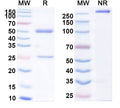 SDS-PAGE for Anti-HBV HBcAg Monoclonal Antibody (1A244)