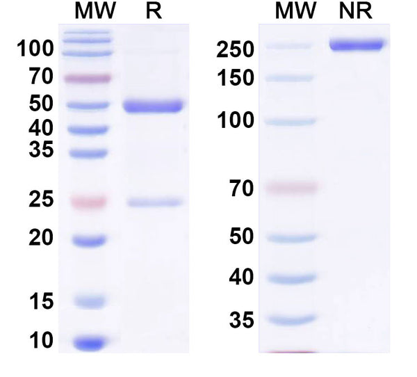 SDS-PAGE for Anti-HBV HBcAg Monoclonal Antibody (1A246)