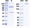 SDS-PAGE for Anti-HBV HBcAg Monoclonal Antibody (1A247)