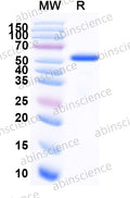 Recombinant MACV Nucleoprotein Protein, N-His – SDS-PAGE