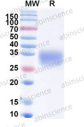 Recombinant MACV Glycoprotein G1 Protein, C-His – SDS-PAGE