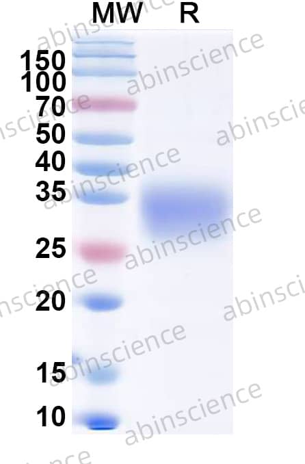 Recombinant MACV Glycoprotein G1 Protein, C-His – SDS-PAGE