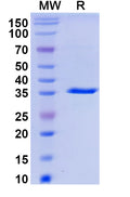 Recombinant Monkeypox virus/MPXV A44R Protein, N-GST & C-His