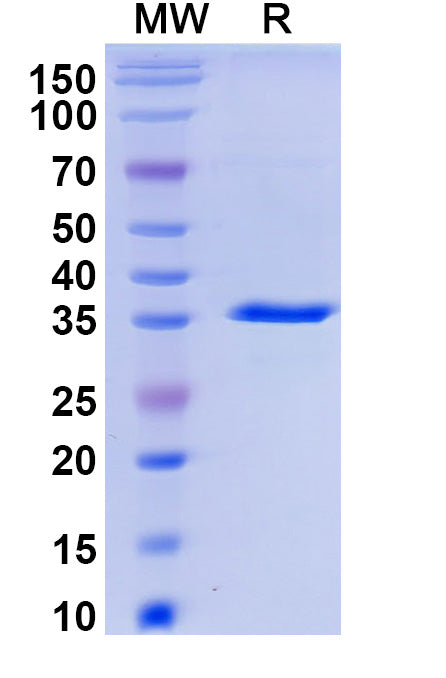 Recombinant Monkeypox virus/MPXV A44R Protein, N-GST & C-His