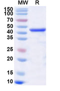 Recombinant PDCoV N/Nucleocapsid protein Protein, N-His