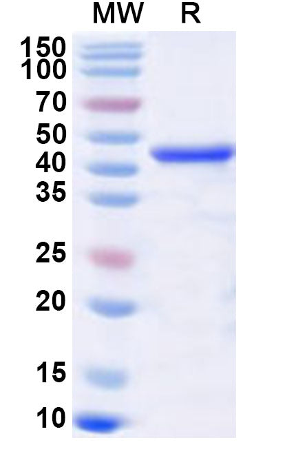 Recombinant PDCoV N/Nucleocapsid protein Protein, N-His