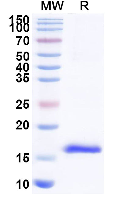 SDS-PAGE for Anti-HIV-1 nef/F-protein protein Nanobody (SAA1423)