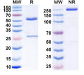 SDS-PAGE for Anti-HBV HBeAg Monoclonal Antibody (1A239)
